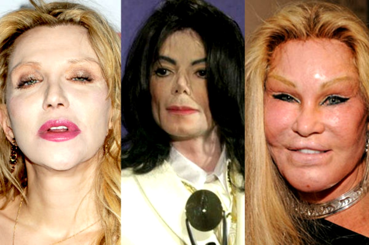 FOTOS de las desastrosas cirugías plásticas de algunos famosos