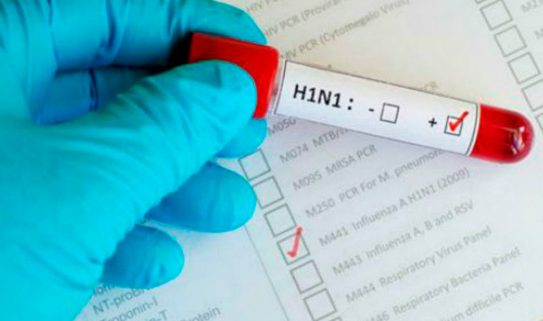 Influenza-H1N1