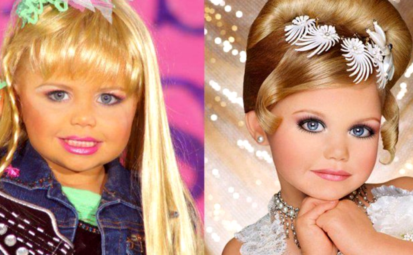 niña modelo implantes