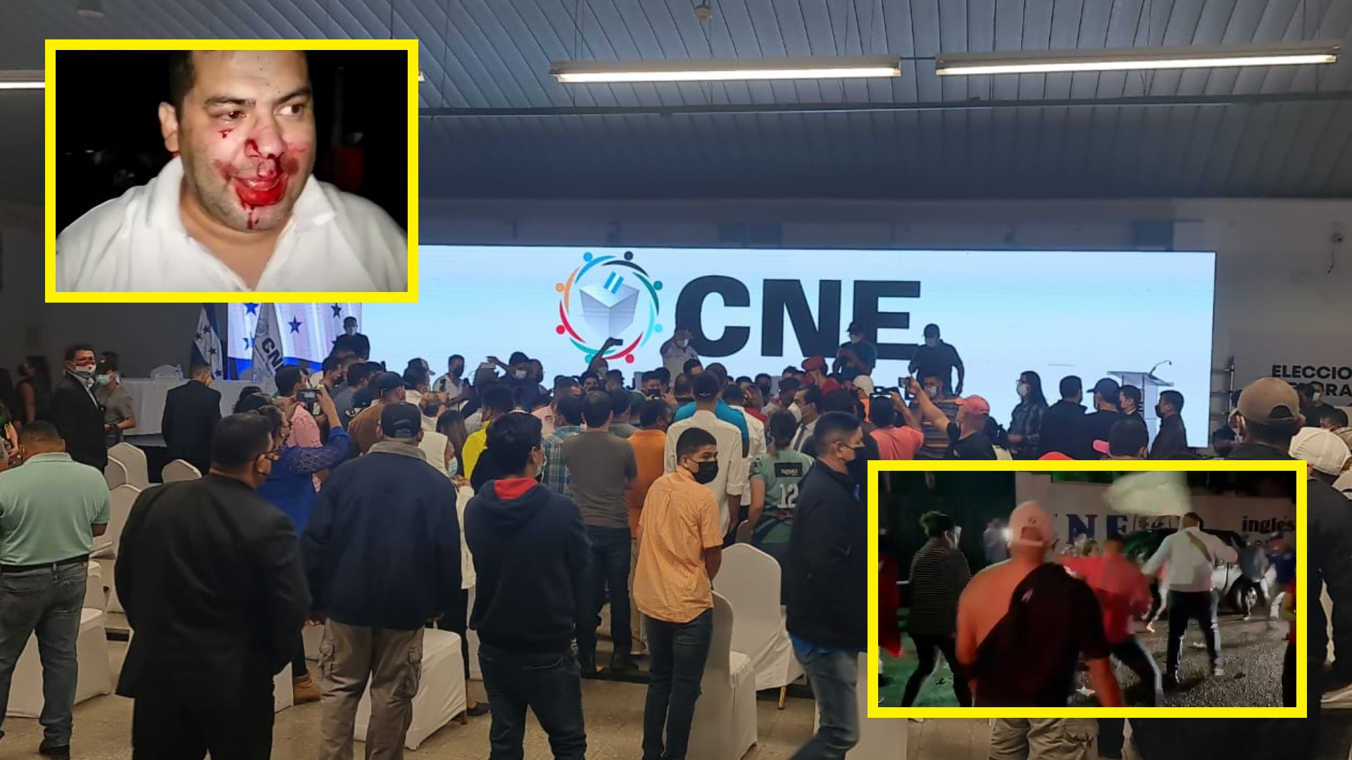 CNE