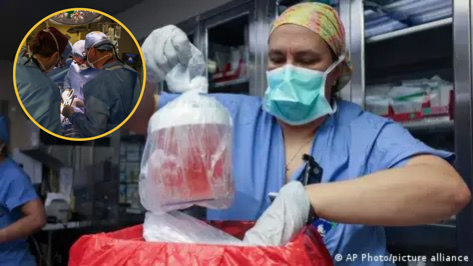 ¡Por primera vez! trasplantan riñón de cerdo a un paciente vivo de 62 años