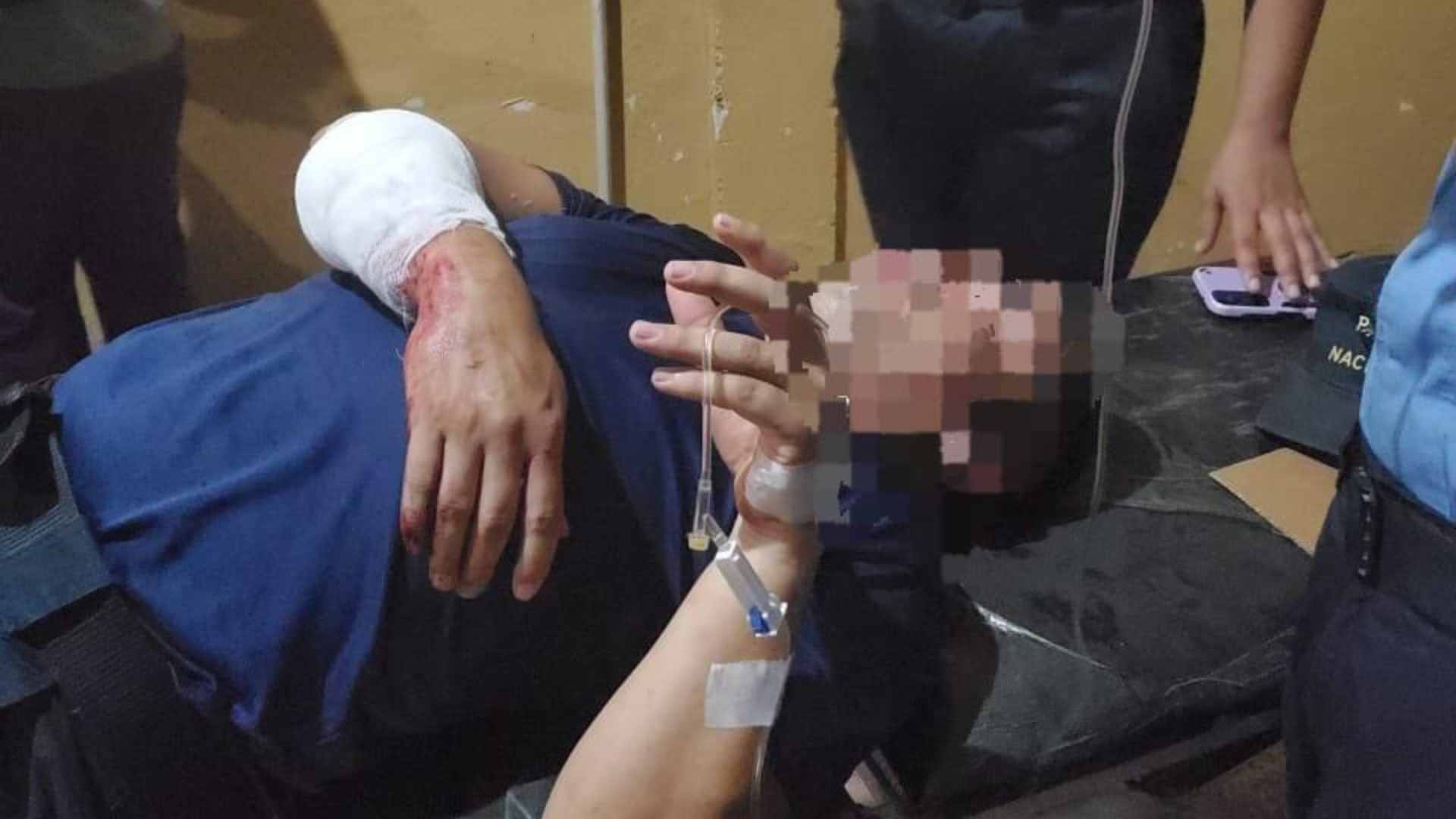 Enfrentamiento deja una persona muerta y tres policías heridos en Talanga