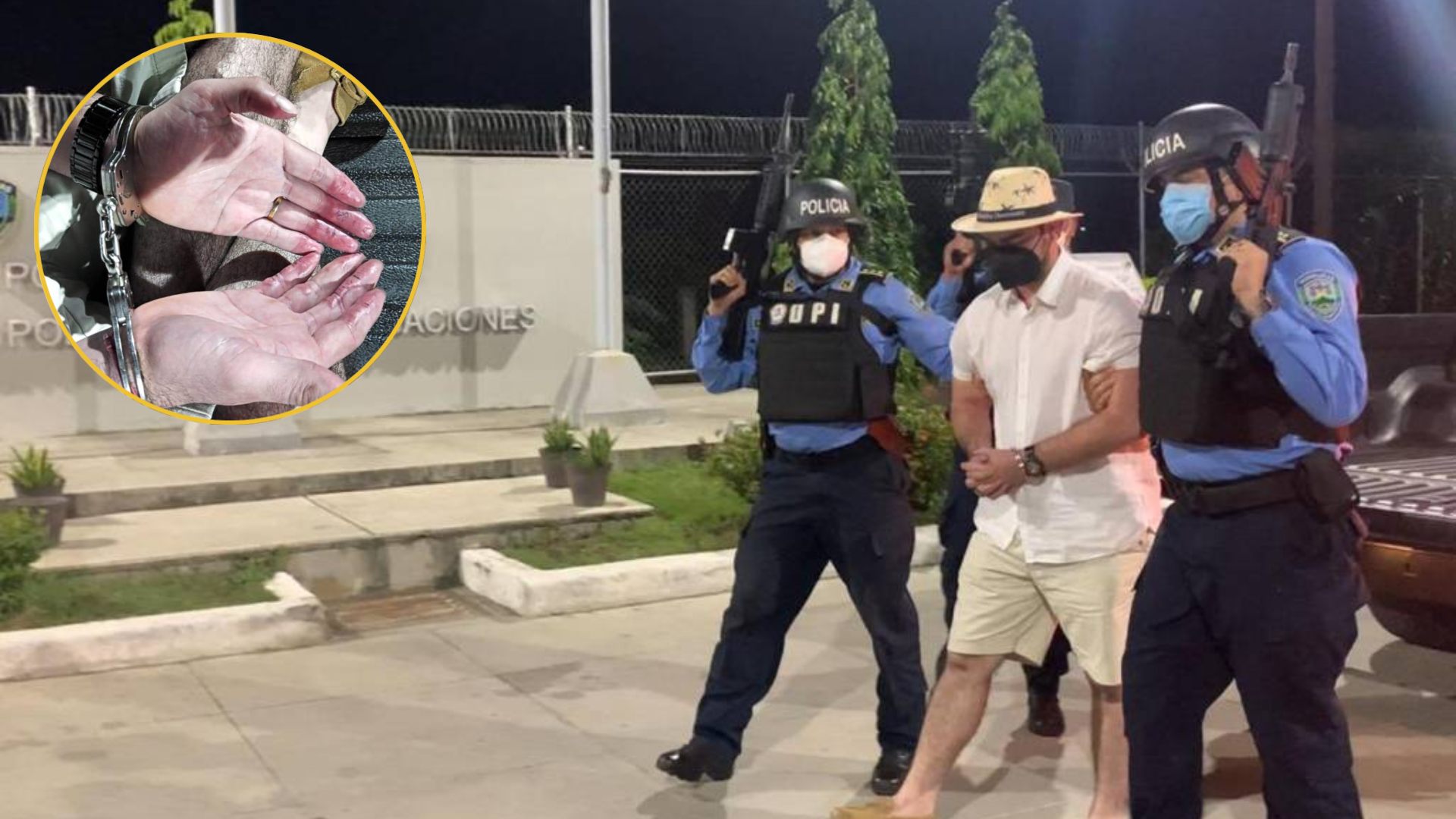 Cabecilla de la pandilla 18 que se eliminó las huellas dactilares con ácido quedará en libertad en SPS