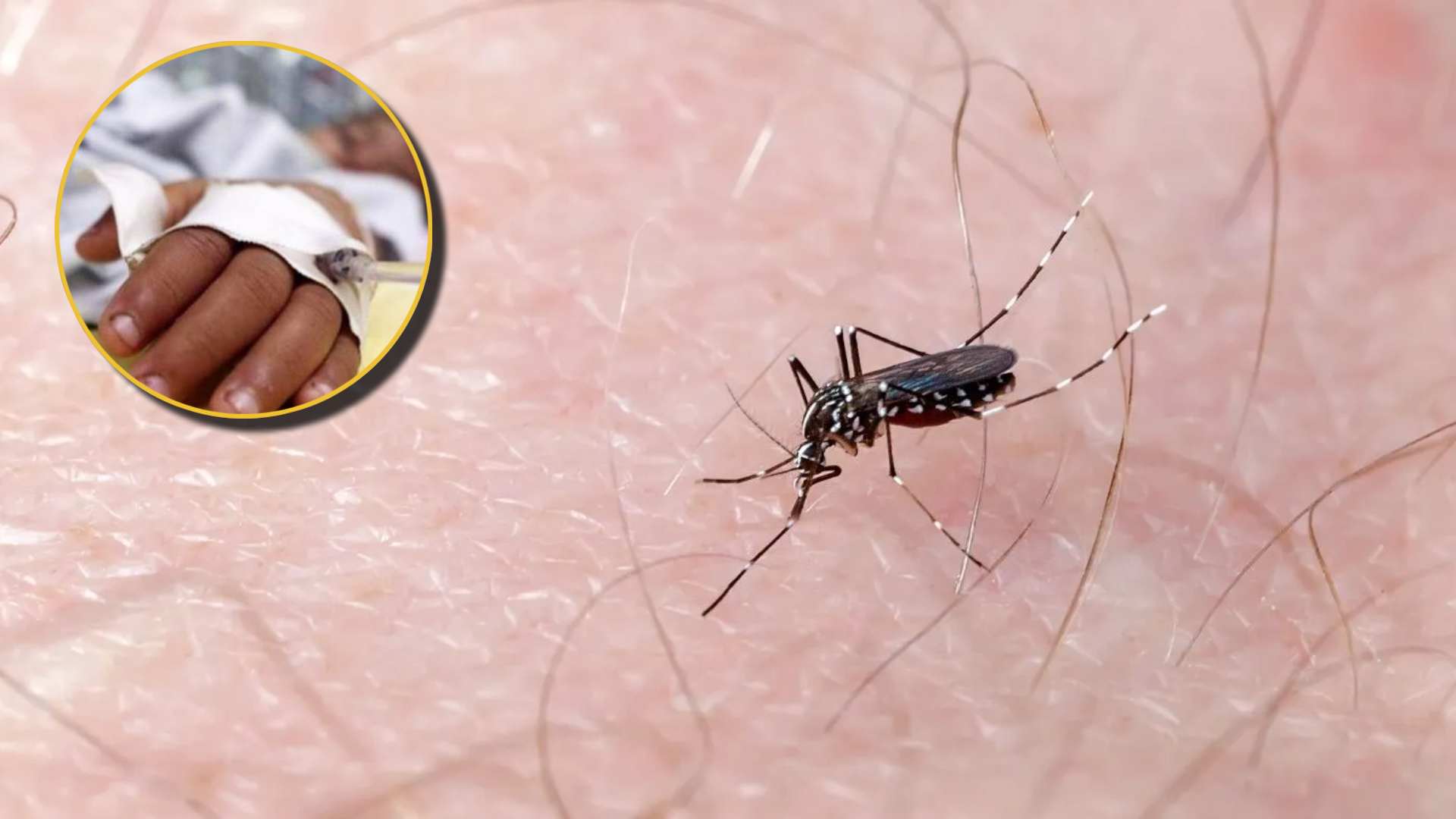 Doctor Umaña alerta sobre estos síntomas del dengue en esta población