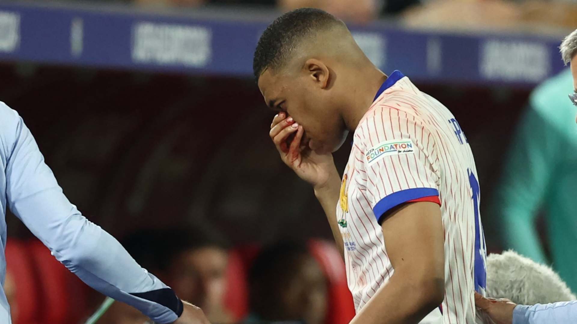 ¿Mbappé se perderá la Eurocopa por su fractura?