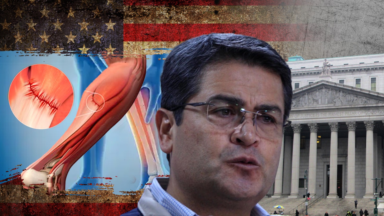 ¿Cirugía a escasos días de la sentencia? Esto se sabe del estado médico del expresidente Hernández