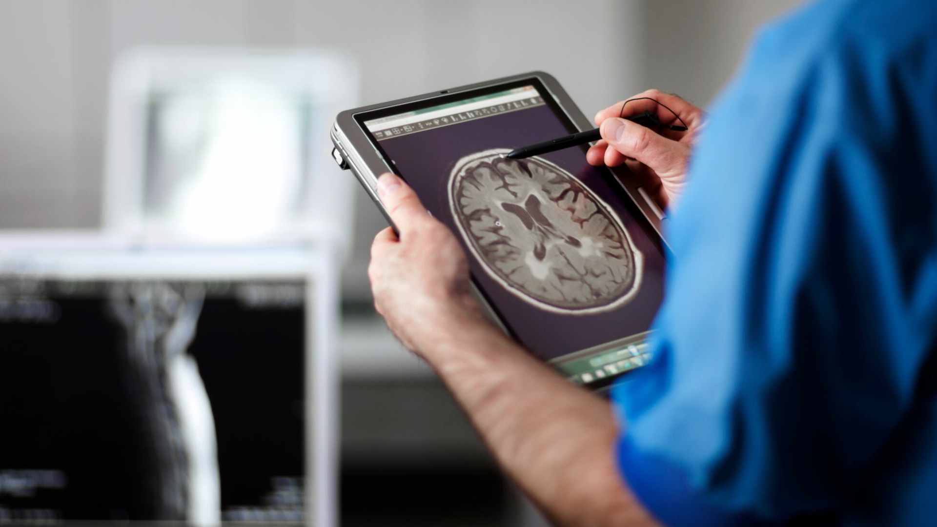 Descubre lo que pasa en el cerebro cuando una persona está muriendo