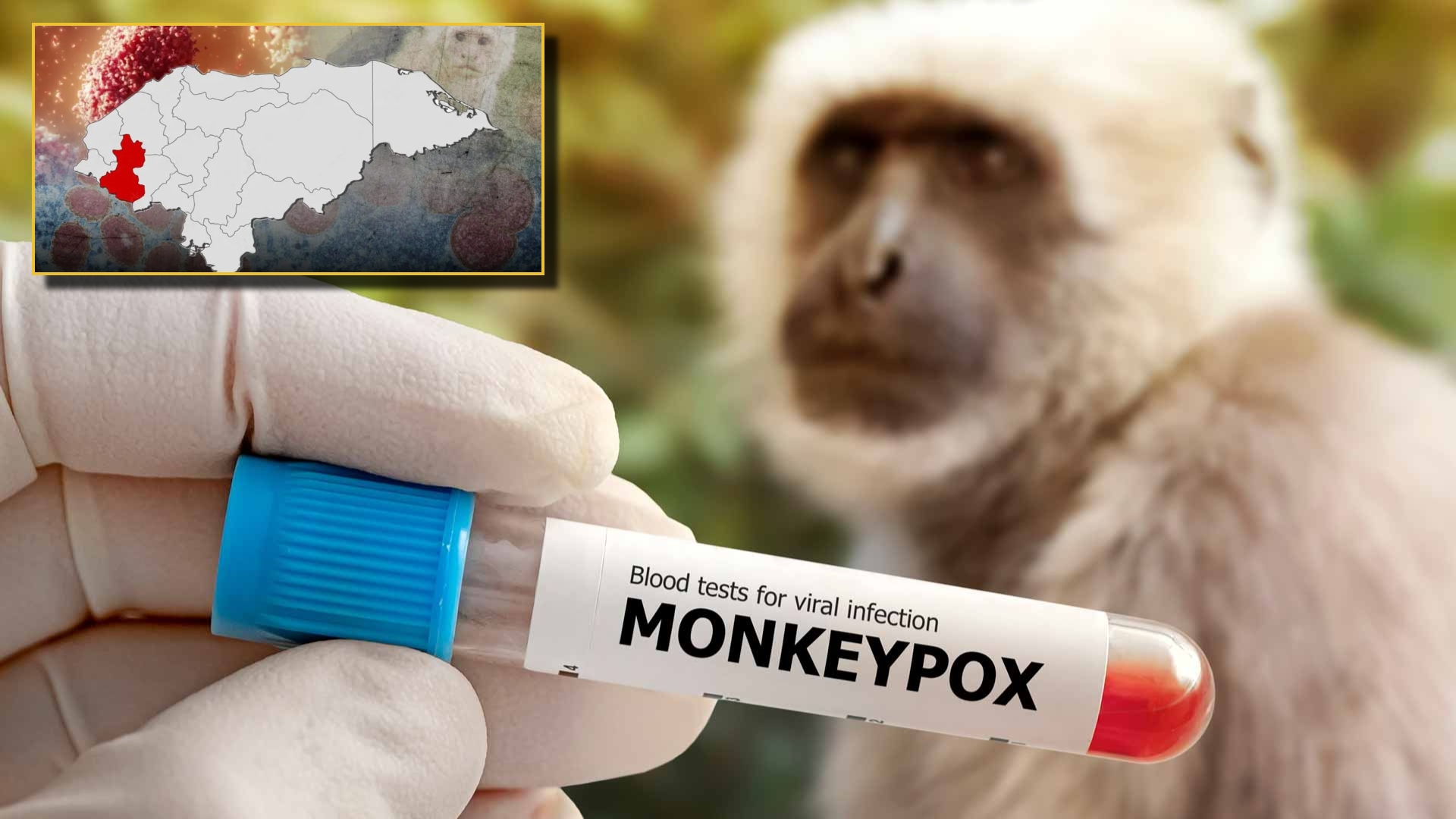 Viruela del mono Honduras