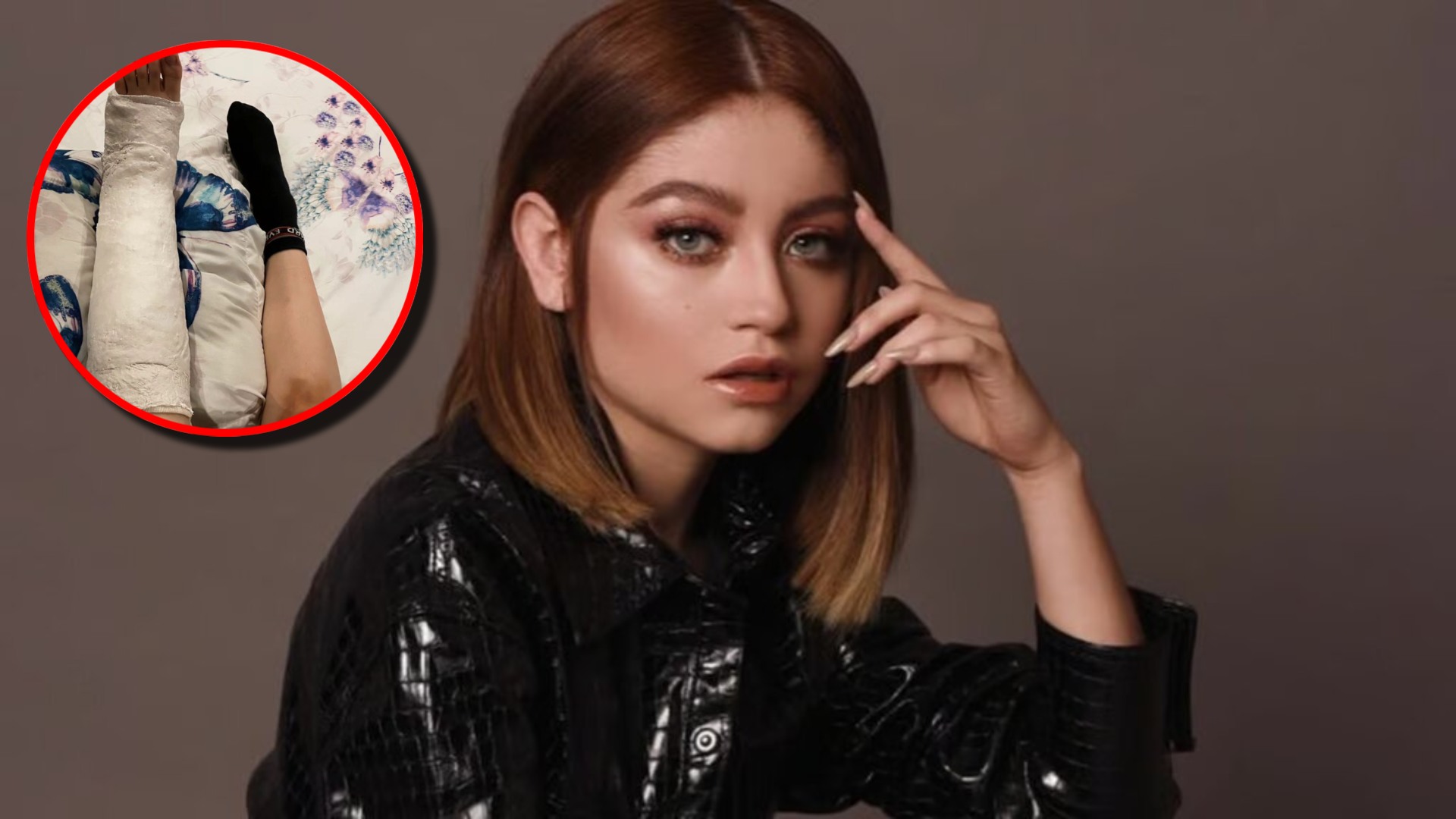 Karol Sevilla sufre lesión esto se sabe