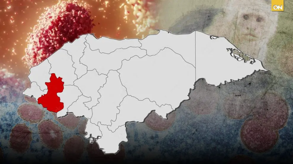 ¿Hay casos de la viruela del mono en Honduras?