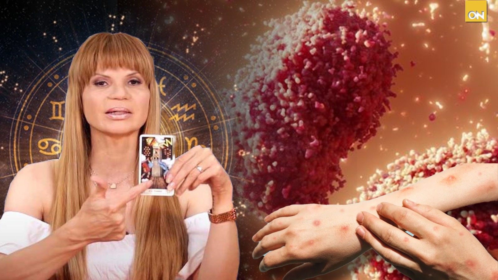 Mhoni Vidente hace alarmante pronóstico sobre la viruela del mono