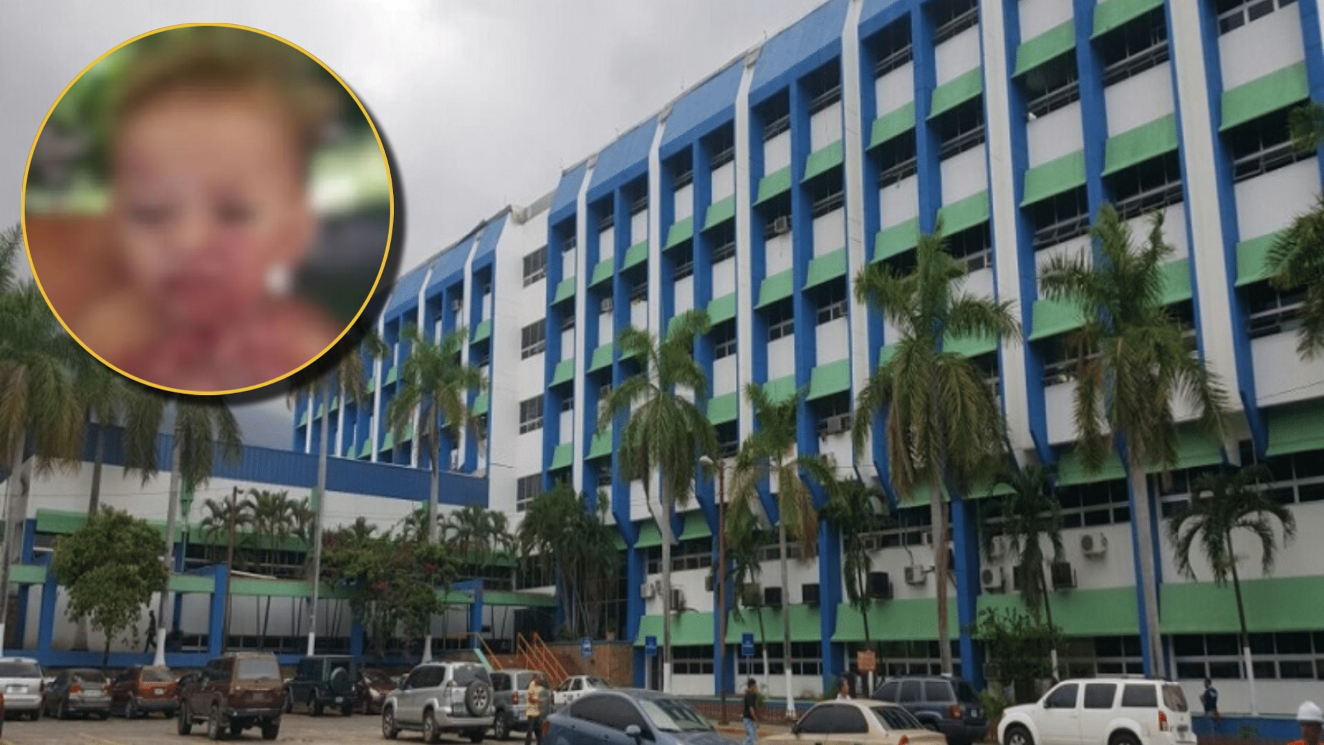 Mujer quemó a niño en San Pedro Sula