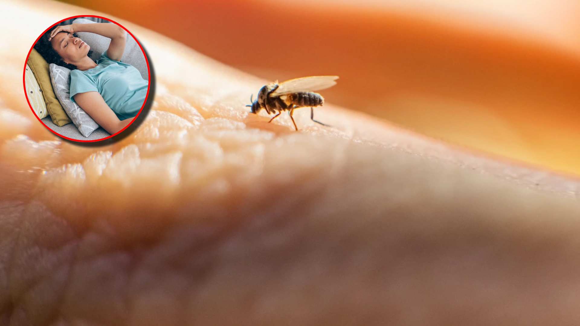 Sesal emite alerta epidemiológica por virus Oropouche