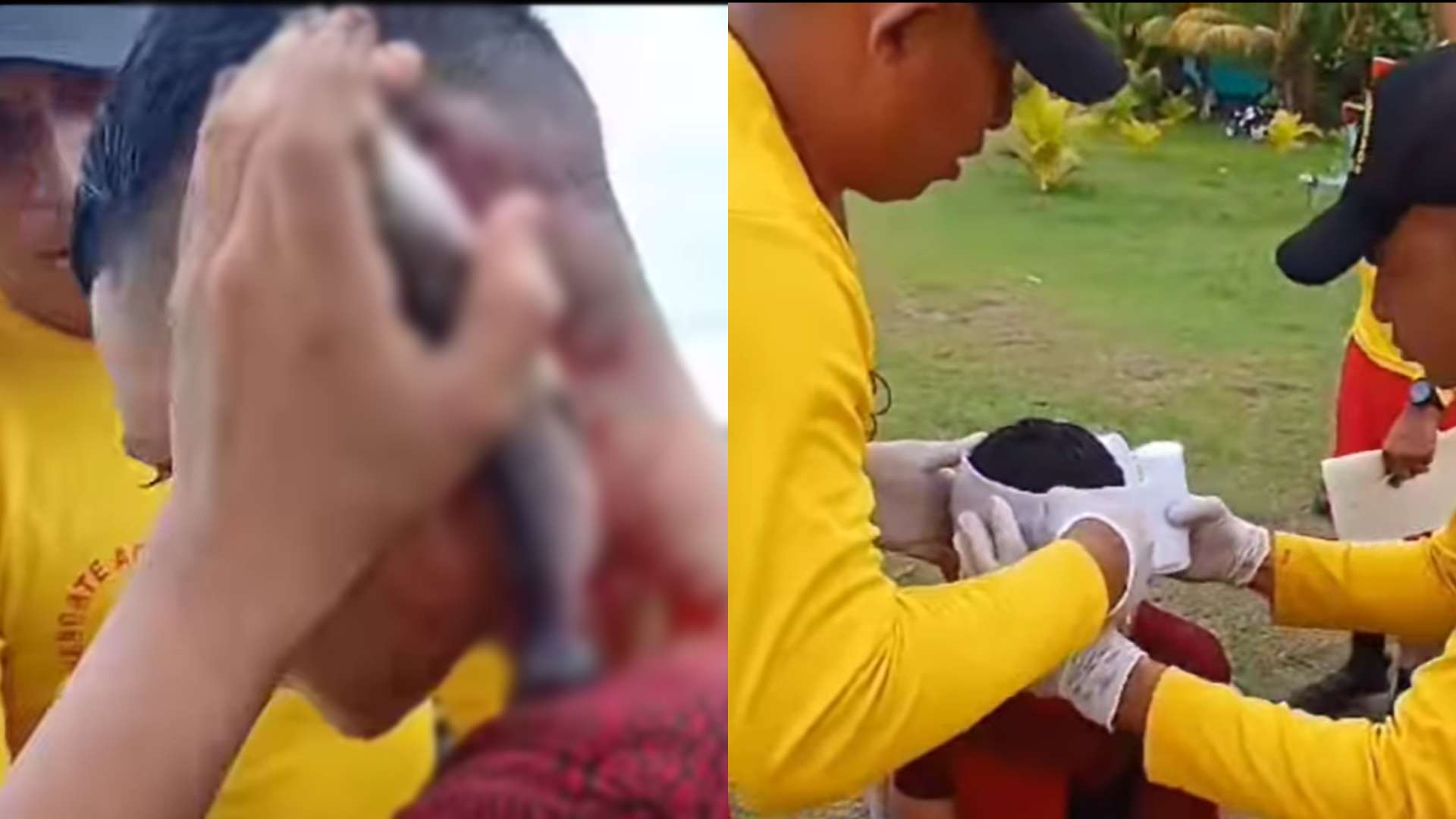 Menor resulta herido porque pez se incrusta en su cabeza en Atlántida