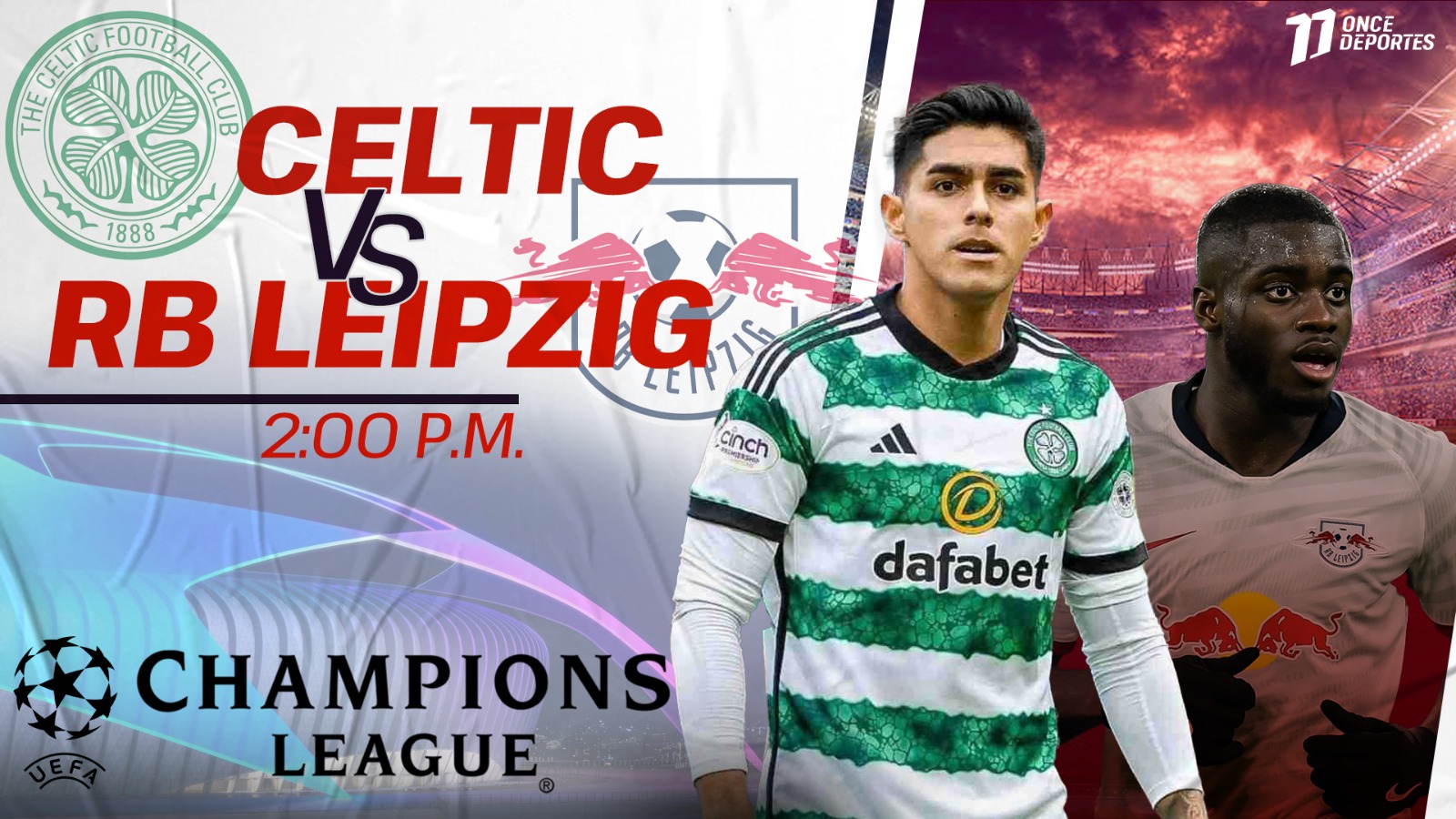 Celtic vs. RB Leipzig Champions League