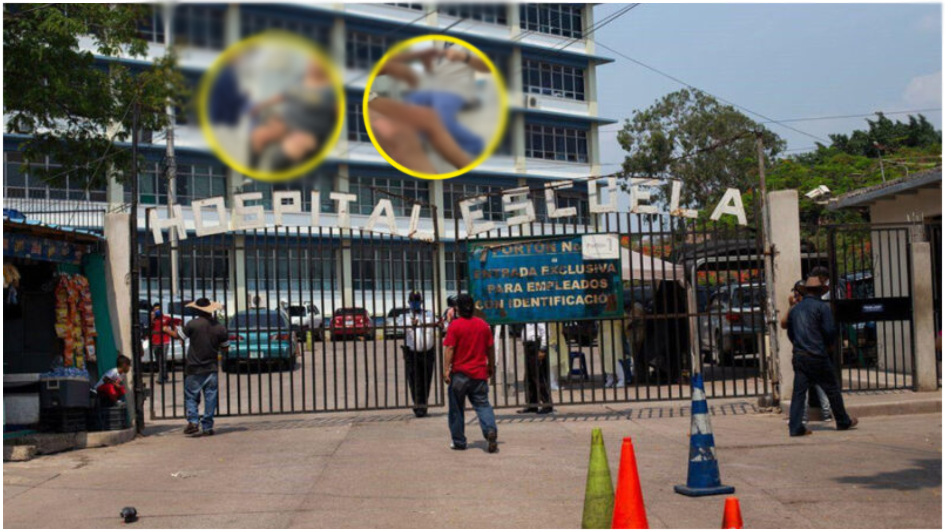 Explosión de cilindro de gas deja dos personas gravemente heridas en Tegucigalpa