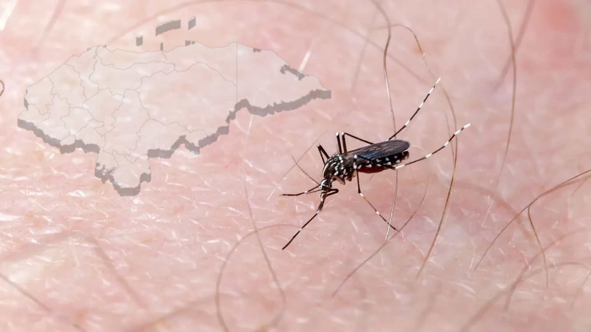 Vacunas contra el dengue comenzarían a aplicarse este mes en Honduras