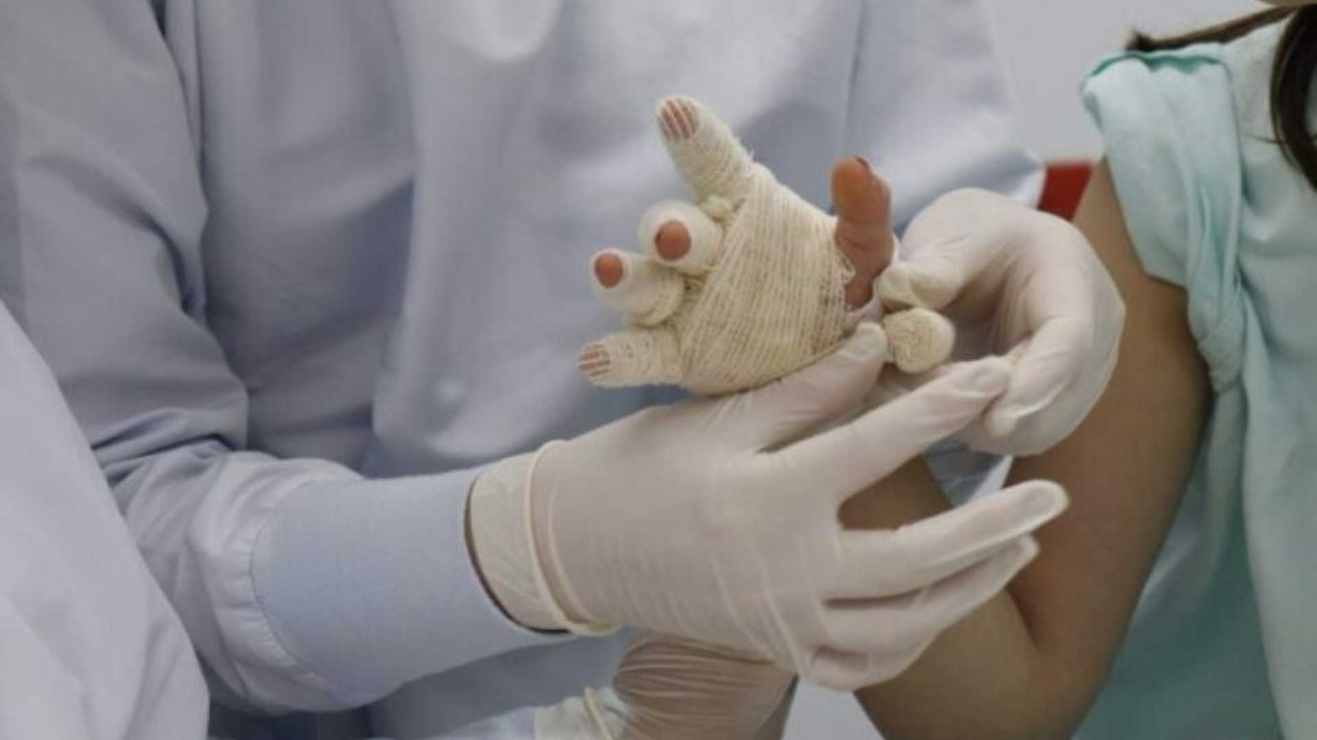 Al menos una docena de niños han sufrido quemaduras de gravedad por manipulación de pólvora en 2024 en Honduras