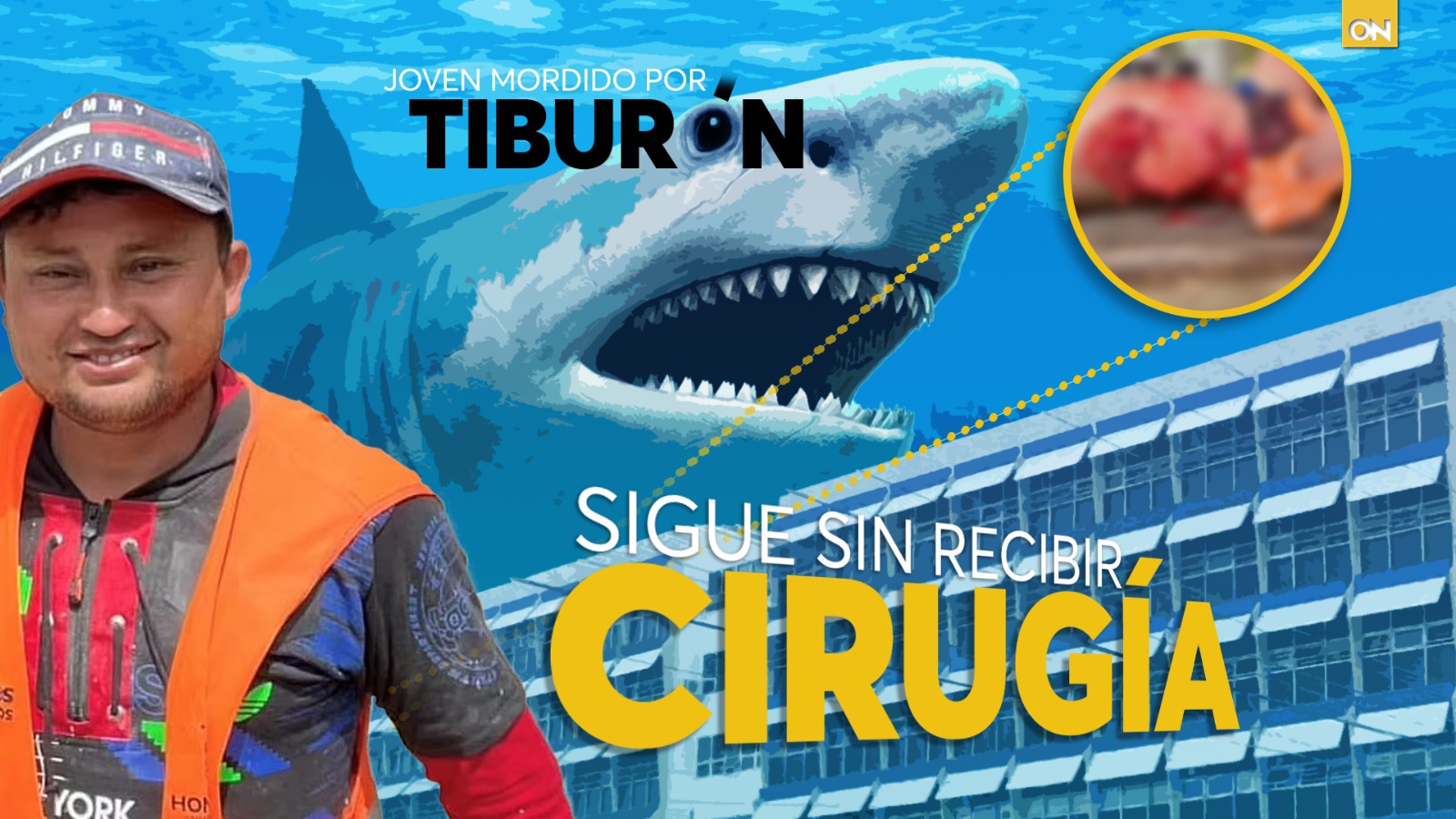 tiburón Hospital Escuela