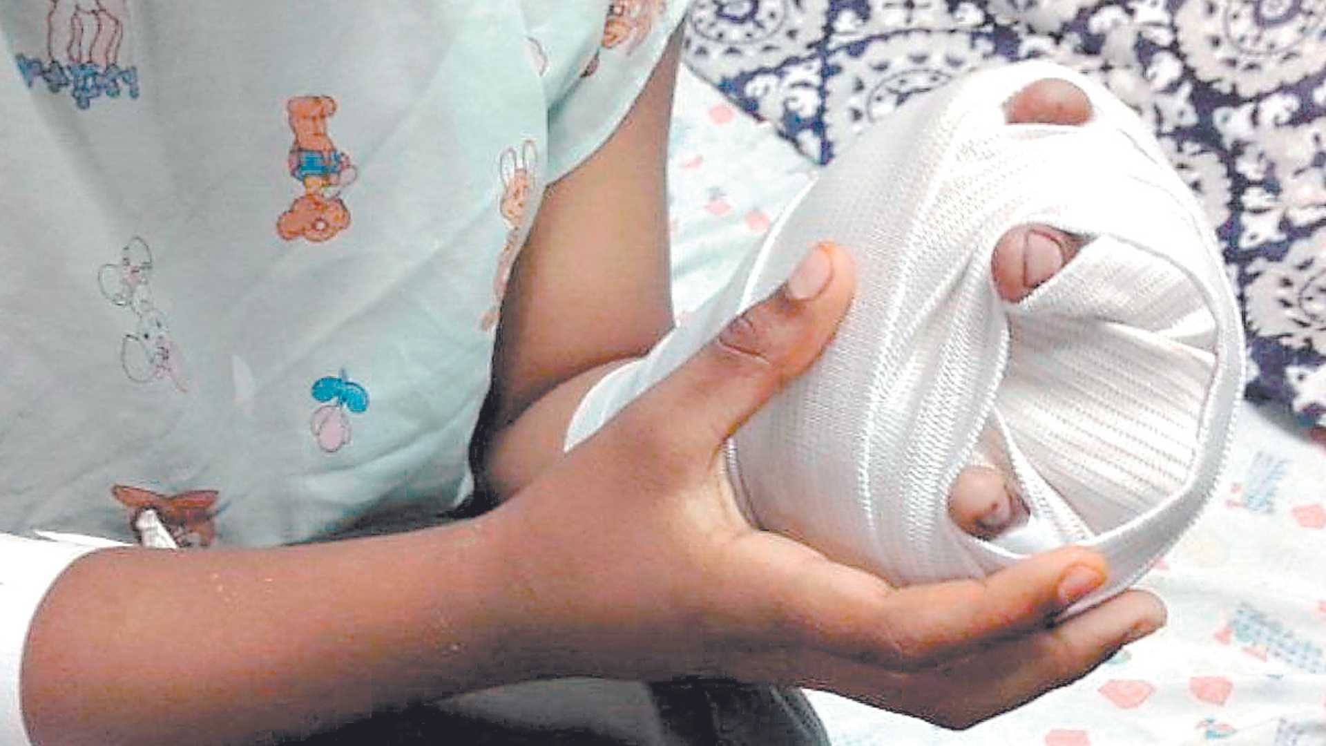 Al menos tres menores quemados en las últimas horas ingresaron al Hospital del Sur