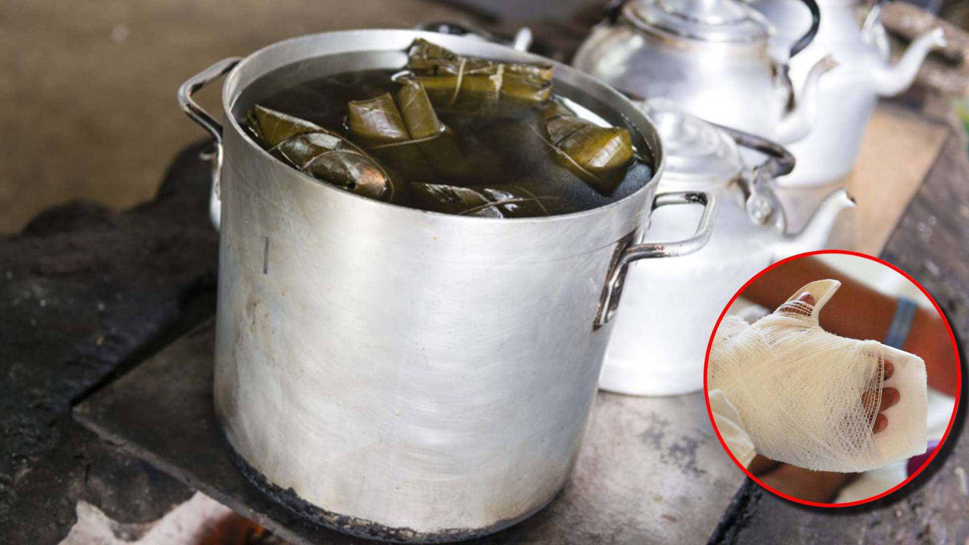 Niños quemados por agua hirviendo de tamales reporta CEHNIQ
