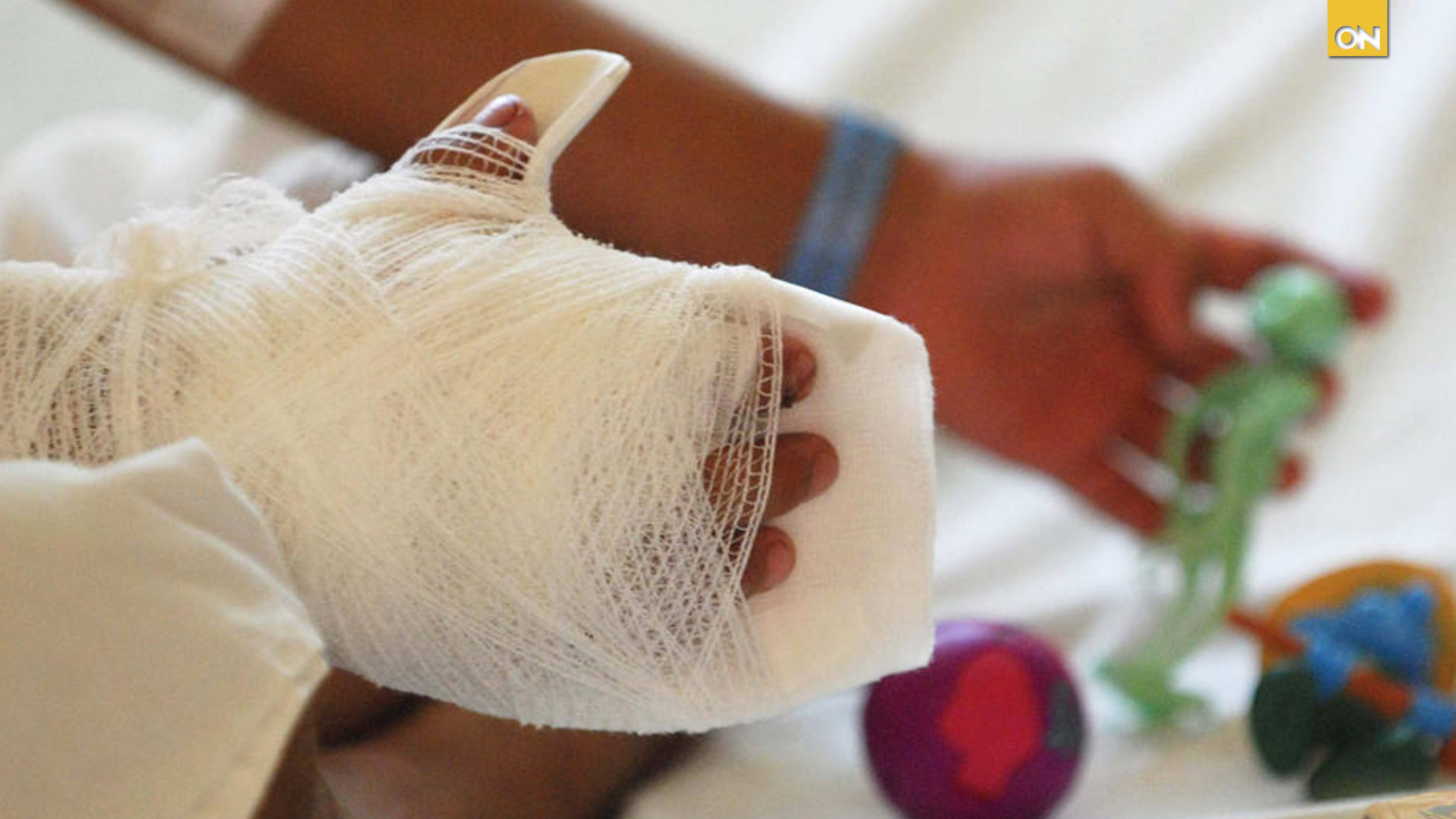 Niños quemados por pólvora