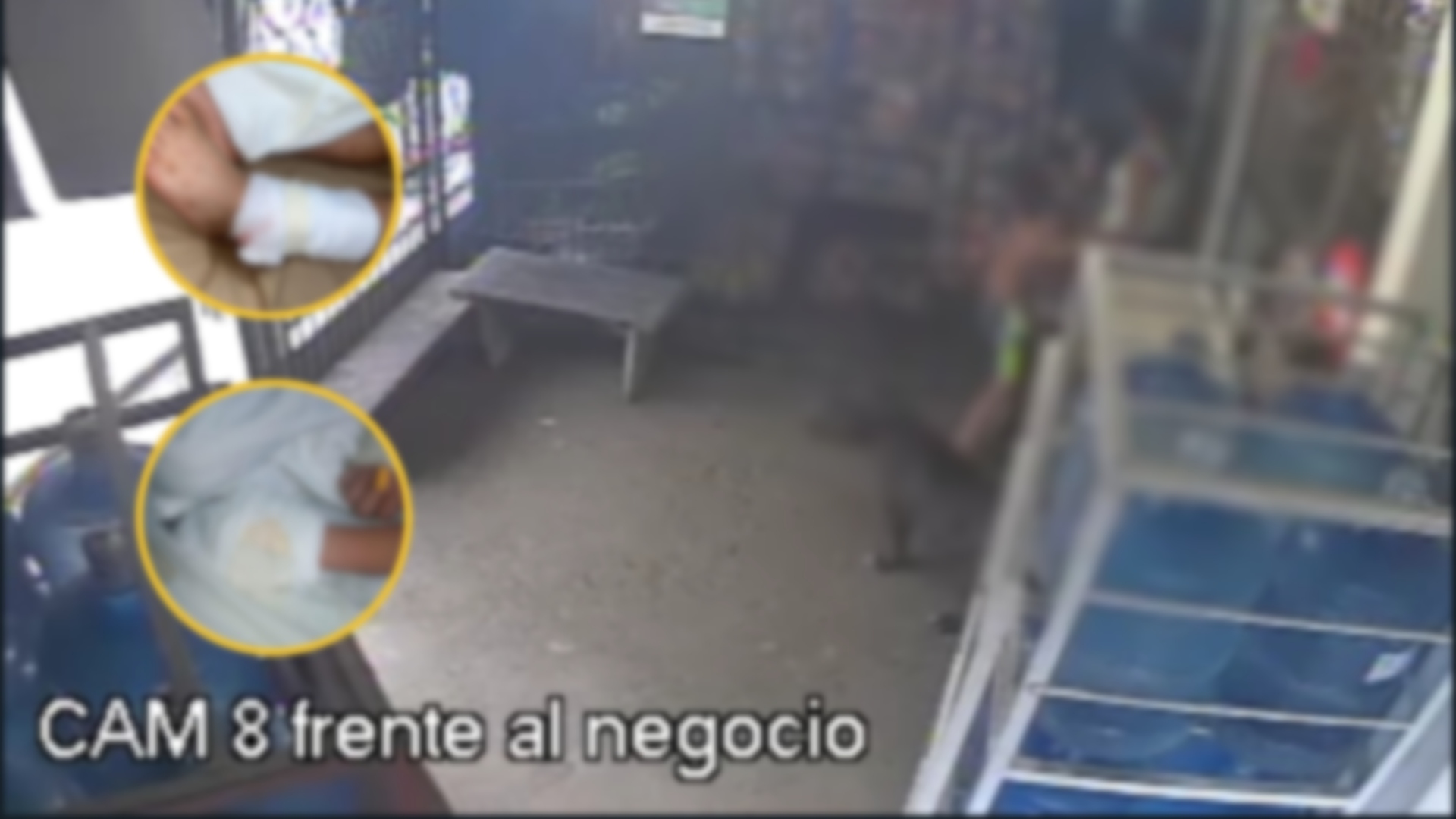 Dos menores gravemente heridos tras ataque de perro Pitbull en Tela, Atlántida