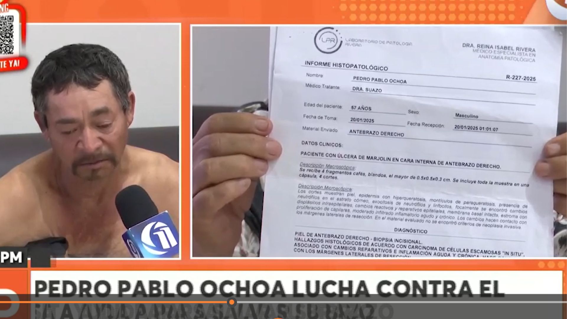 ayuda honduras cancer