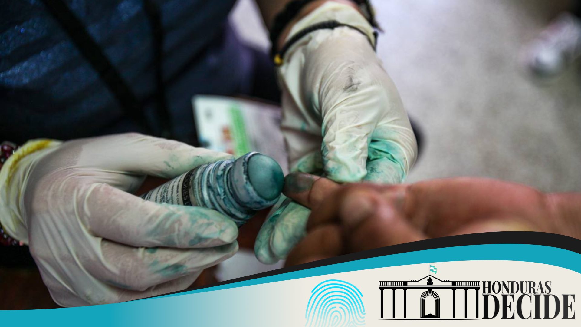 CNE repetir elecciones DC