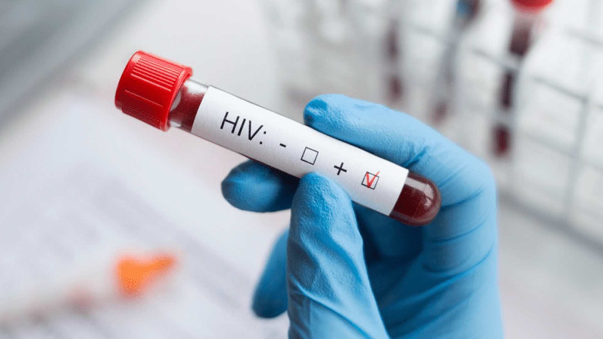 ¿Qué es? ¿Cómo se transmite? ¿Cuáles son los síntomas?: Preguntas frecuentes sobre el VIH