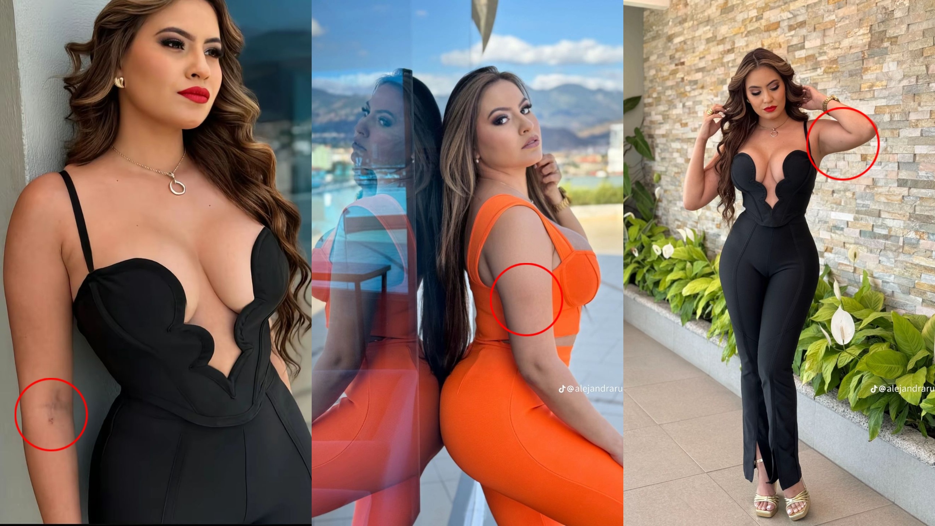 Alejandra Rubio golpeada
