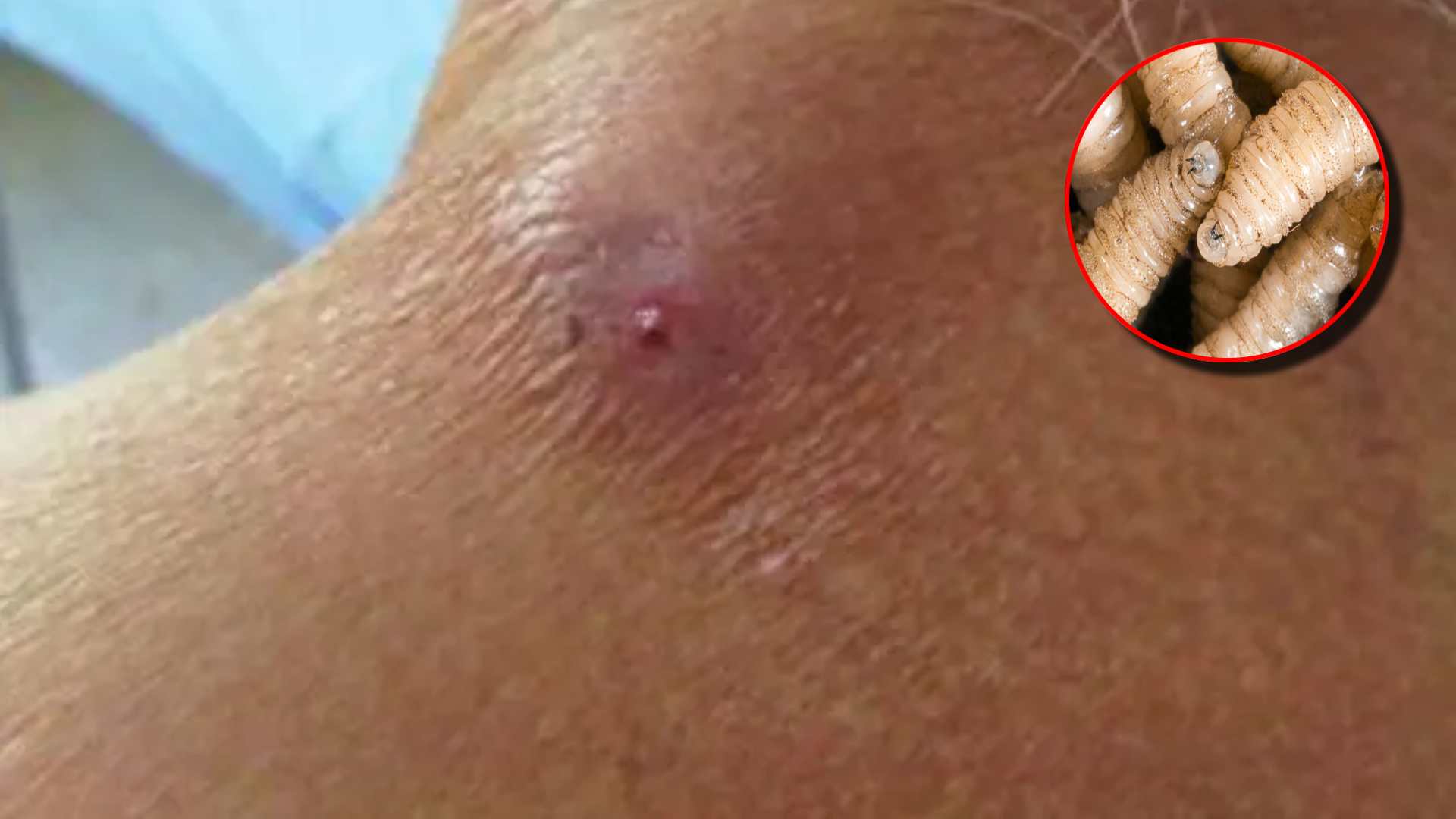 Honduras confirma la primera muerte por infección de gusano barrenador