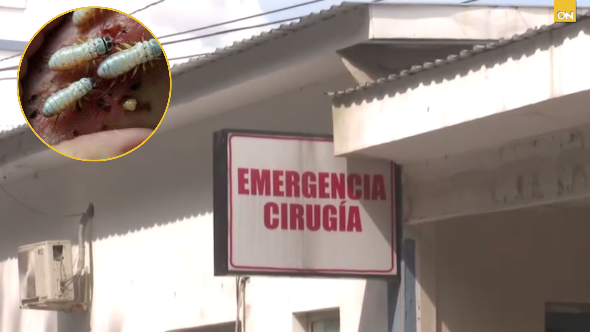 Extraen al menos 40 gusanos barrenadores del cuerpo de una mujer en el departamento de Cortés