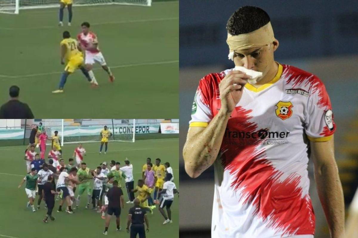 Puñetazos y patadas: así fue la pelea entre jugadores del Herediano y Victoria en el 'nuevo' estadio de La Ceiba