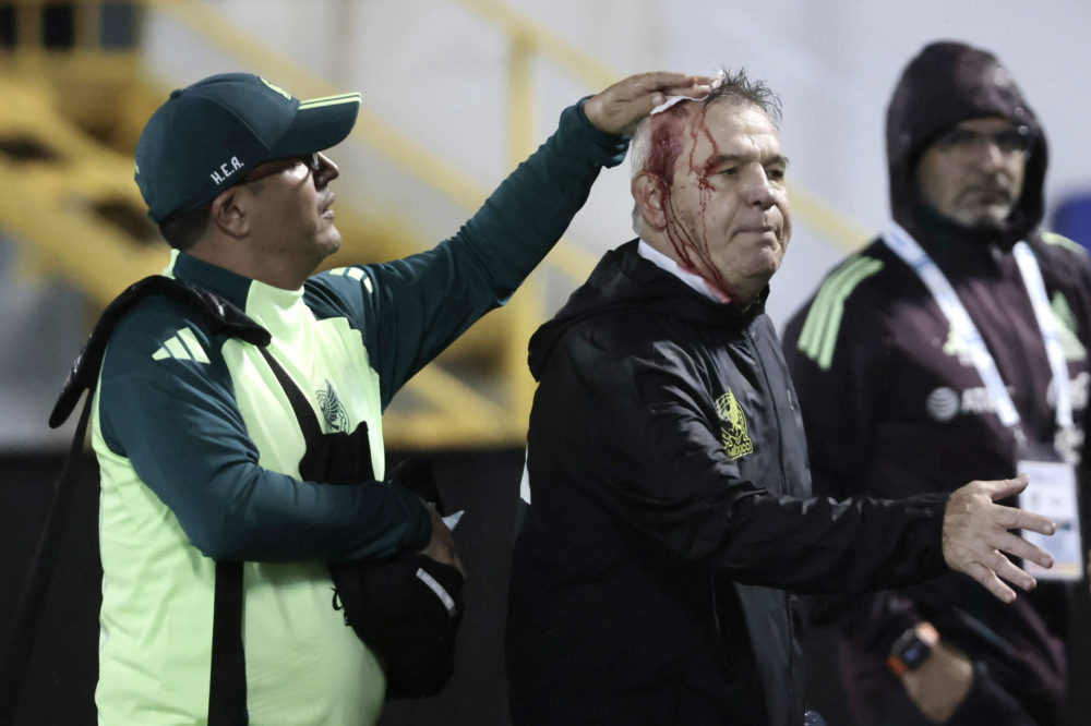 Agresión a Aguirre en Honduras pone en la mira la seguridad del Estadio Francisco Morazán – Diario Deportivo Más