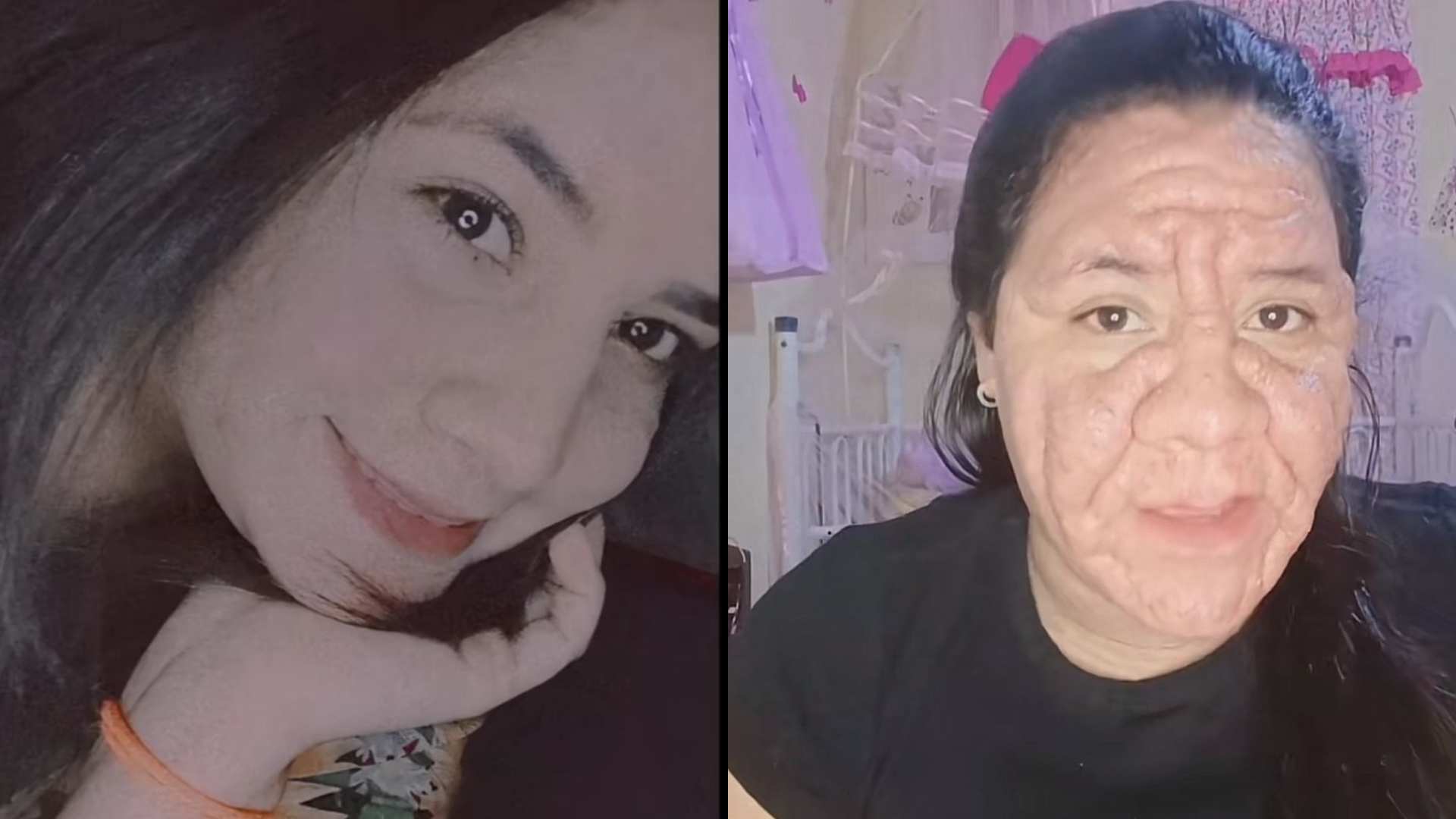 deformación facial por embarazo