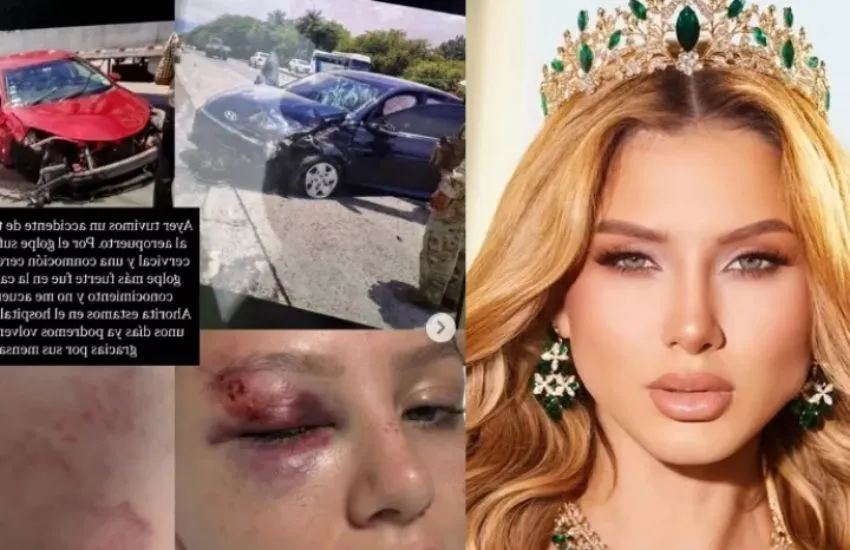 miss costa rica Miss Costa Rica 2025, hospitalizada tras accidente en Panamá
