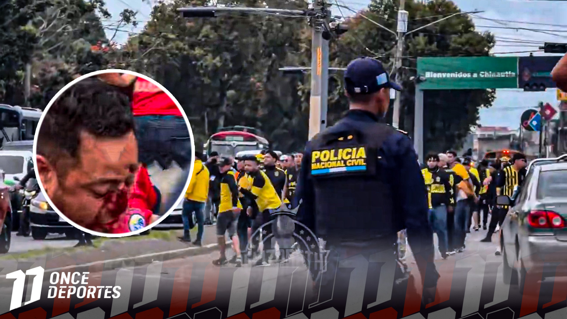 La violencia se hizo presente: Aficionados de Real España y Xelajú se van a los golpes previo al partido por la Copa Centroamericana