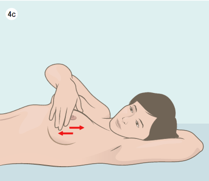 Pasos para realizar el autoexamen de mamas