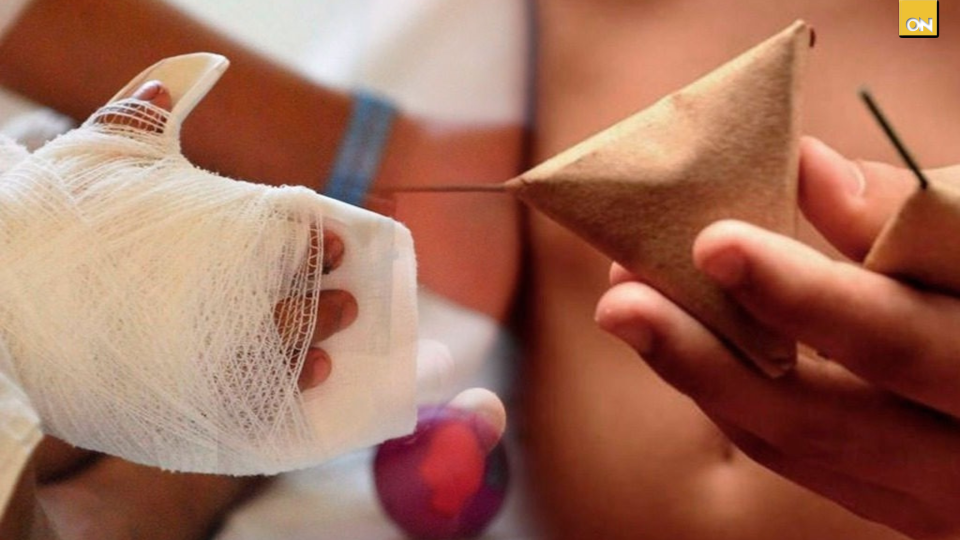 Al menos una docena de hondureños ingresados por quemas a causa de pólvora
