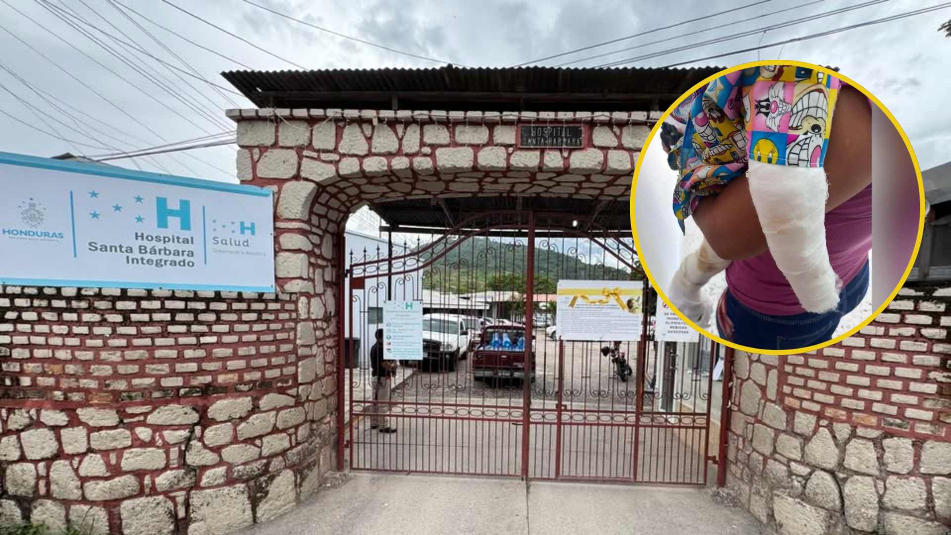 ¿Cómo se encuentra el menor atacado presuntamente por su padrastro en Santa Bárbara?