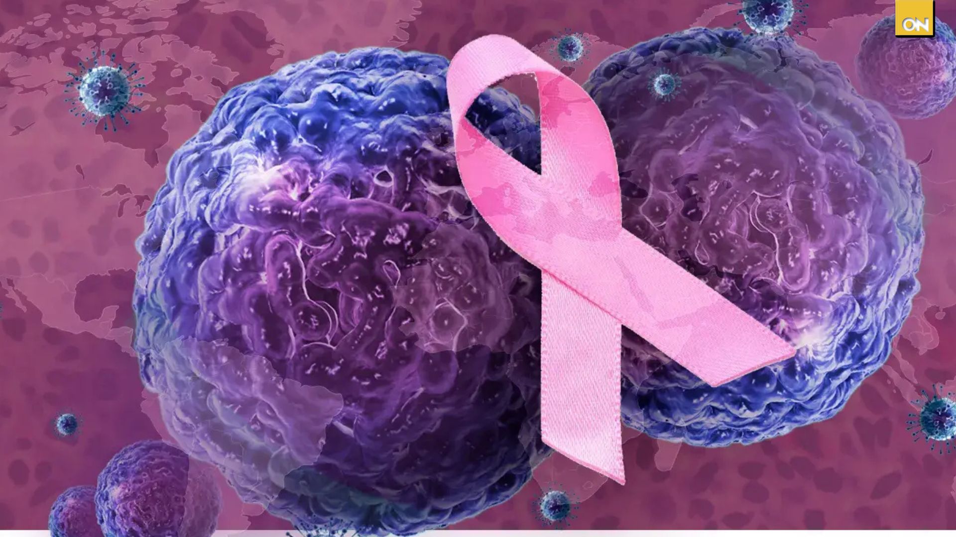 Consultorio del Once: Conoce los síntomas del cáncer algunos son mas comunes de lo que te imaginas