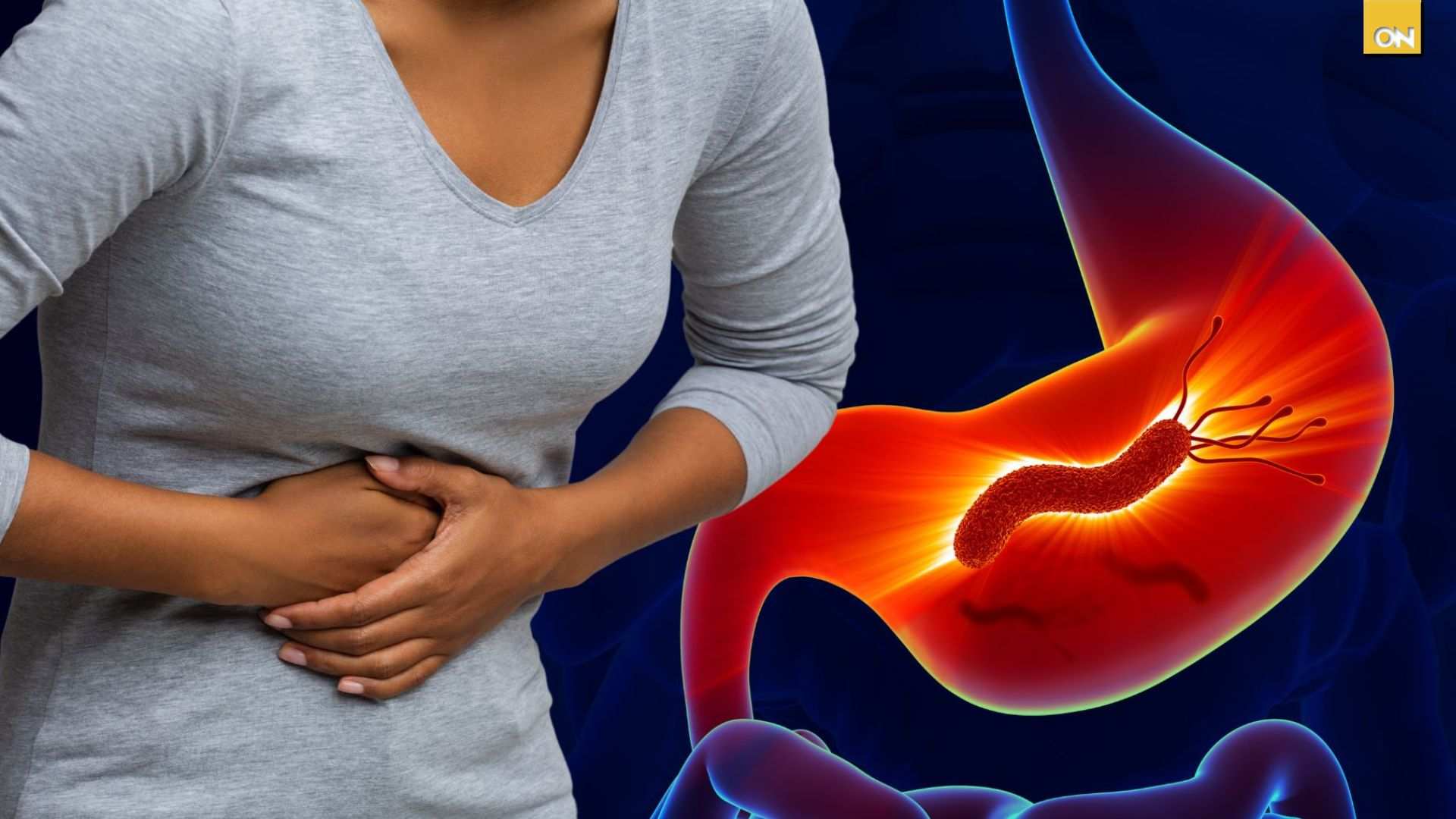 El Consultorio del Once: Descubre cómo saber si estás sufriendo de Helicobacter pylori