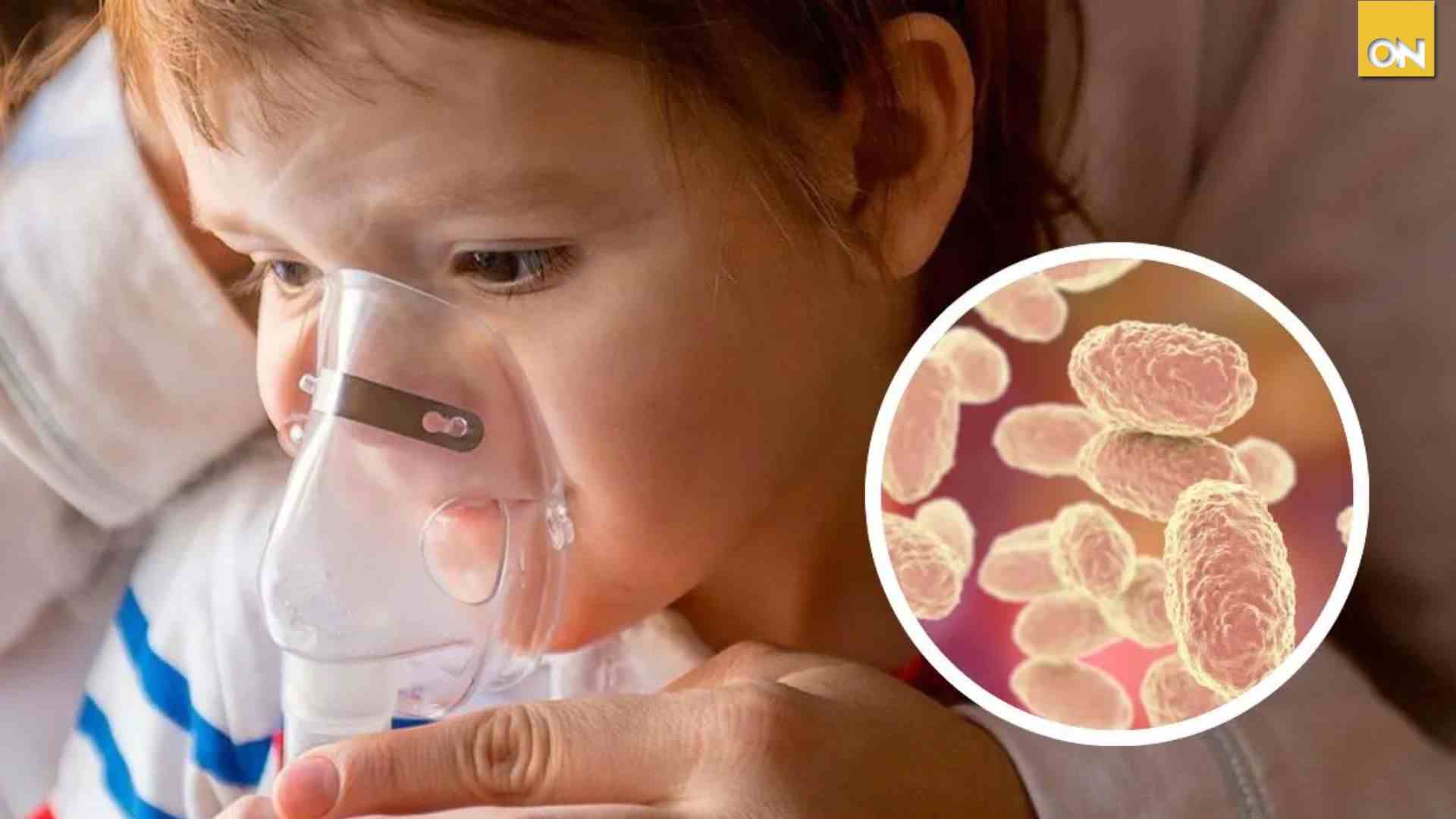tos ferina deja nueve bebés fallecidos en 2026 y miles siguen sin vacunarse en Honduras