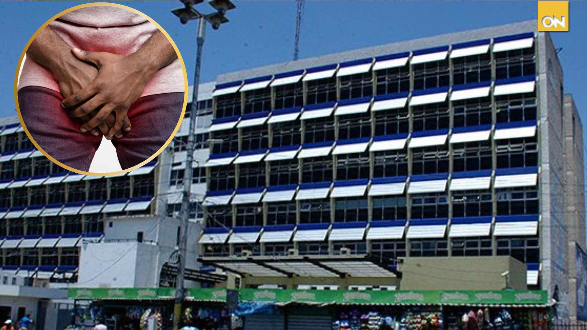amputaciones cáncer hombres infecciones