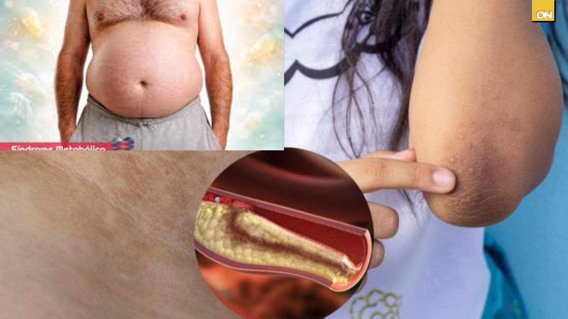 El Consultorio del Once: Cansancio frecuente y aumento de grasa abdominal podrían ser señales de síndrome metabólico