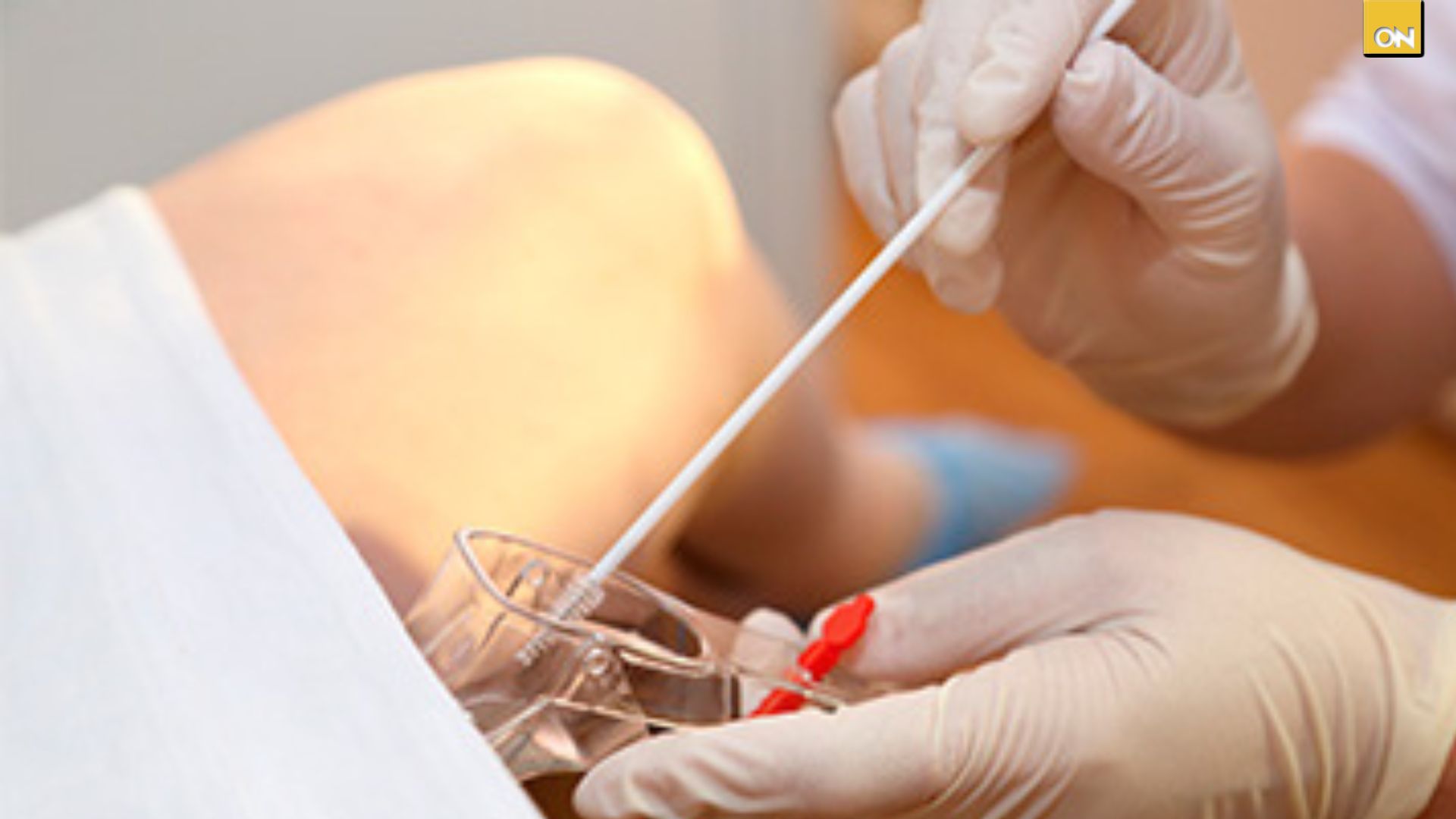 El Consultorio del Once: Flujo anormal y mal olor síntomas que podrían indicar una infección vaginal