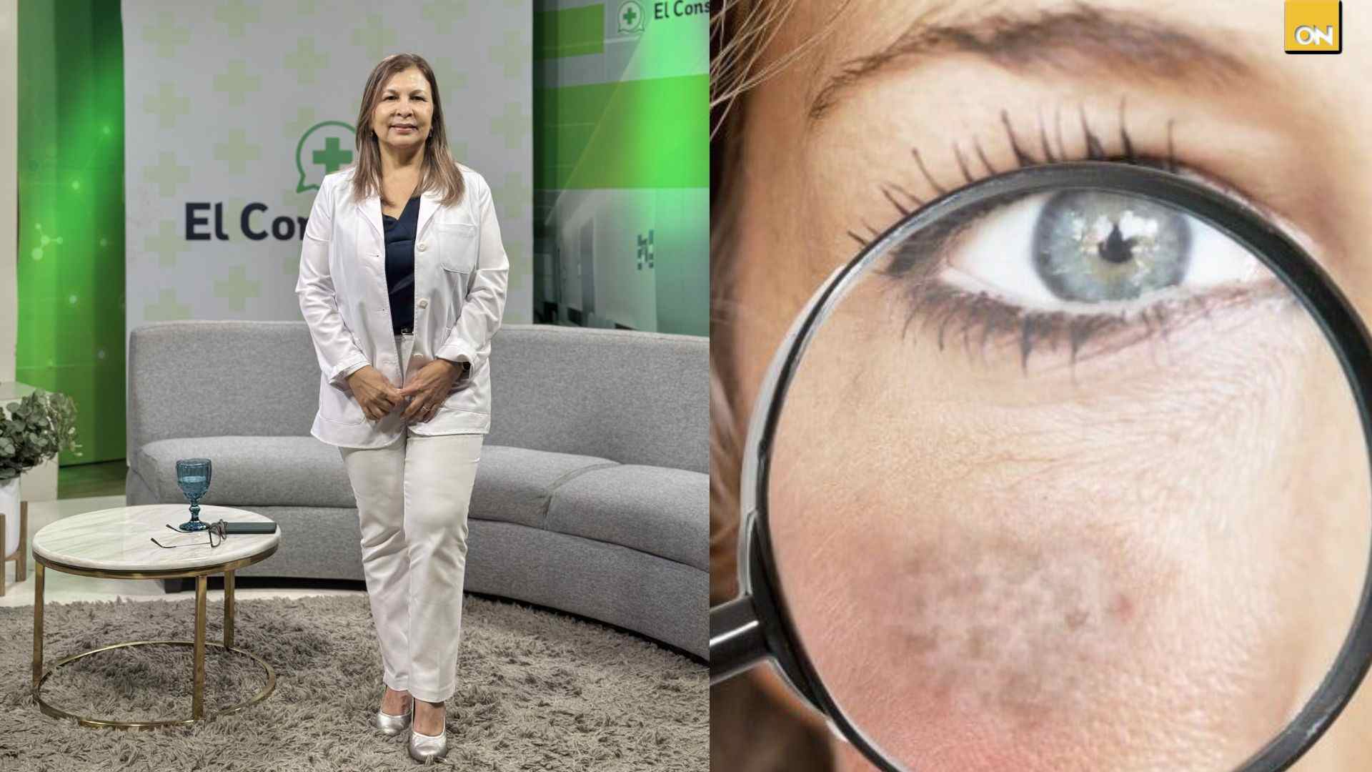 El Consultorio del Once: Dermatóloga Claudia Martínez explica por qué aparecen las manchas en la piel