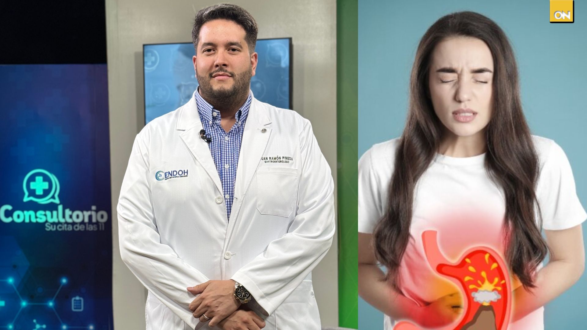 El doctor Ramón Pineda explicó cómo identificar la gastritis y alerta sobre los riesgos de automedicarse