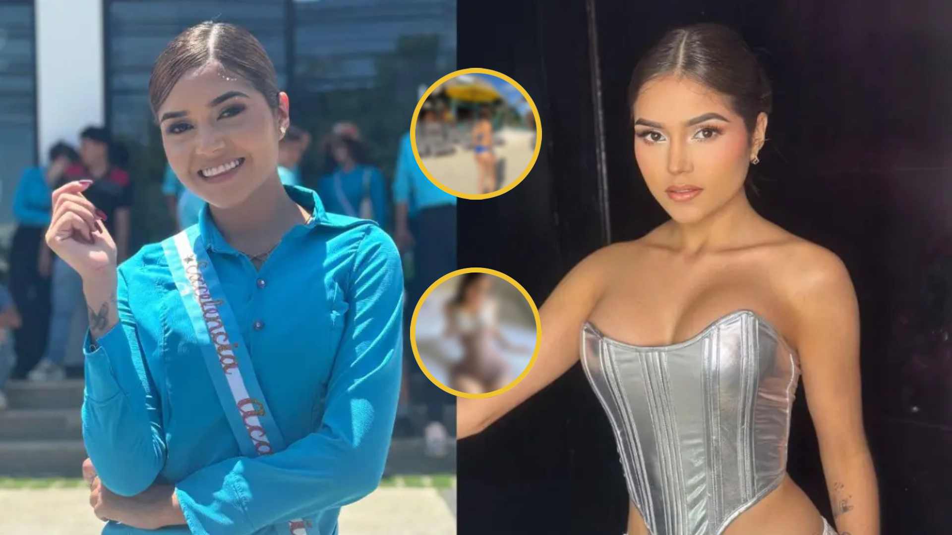 ¿Irreconocible? 😳 Tiktoker “La Oruga” sorprende al mostrar su nueva figura tras cirugía estética